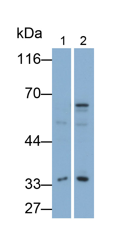 Monoclonal Antibody to Galectin 3 (GAL3)