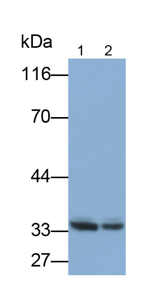 Monoclonal Antibody to Galectin 3 (GAL3)