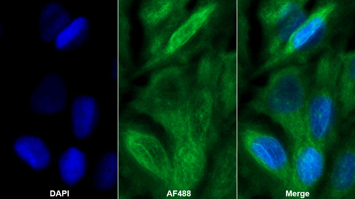 Monoclonal Antibody to Galectin 7 (GAL7)