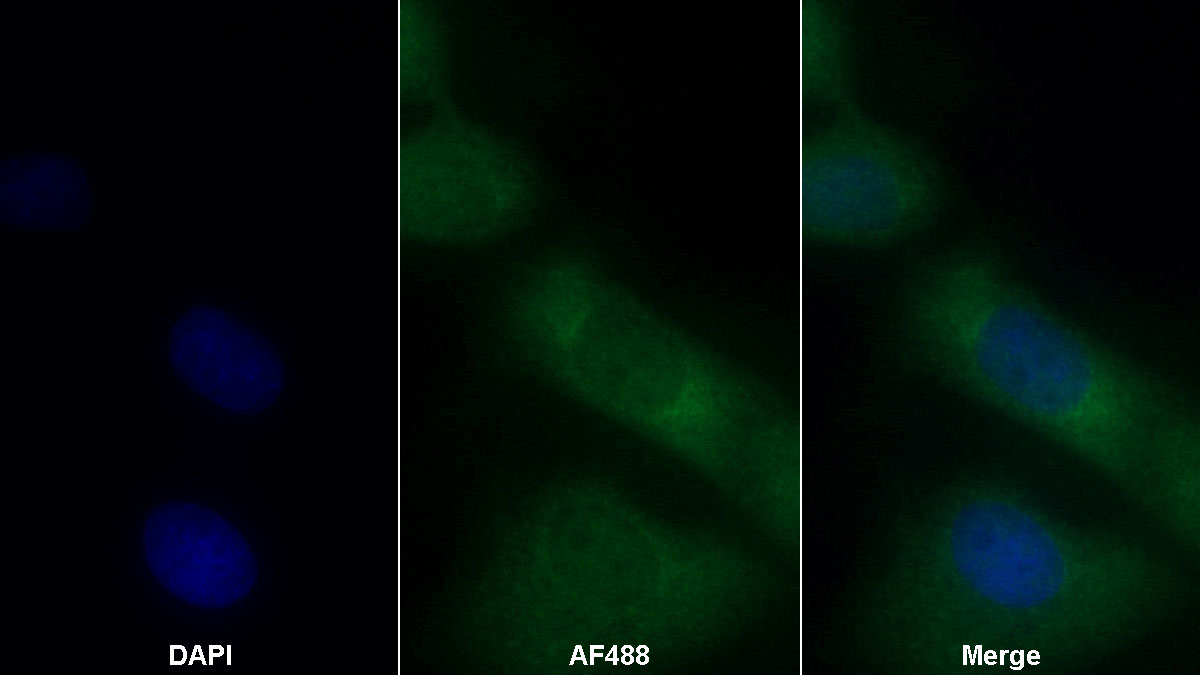 Monoclonal Antibody to Galectin 8 (GAL8)