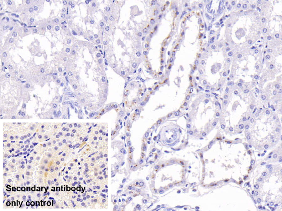 Monoclonal Antibody to Apolipoprotein H (APOH)