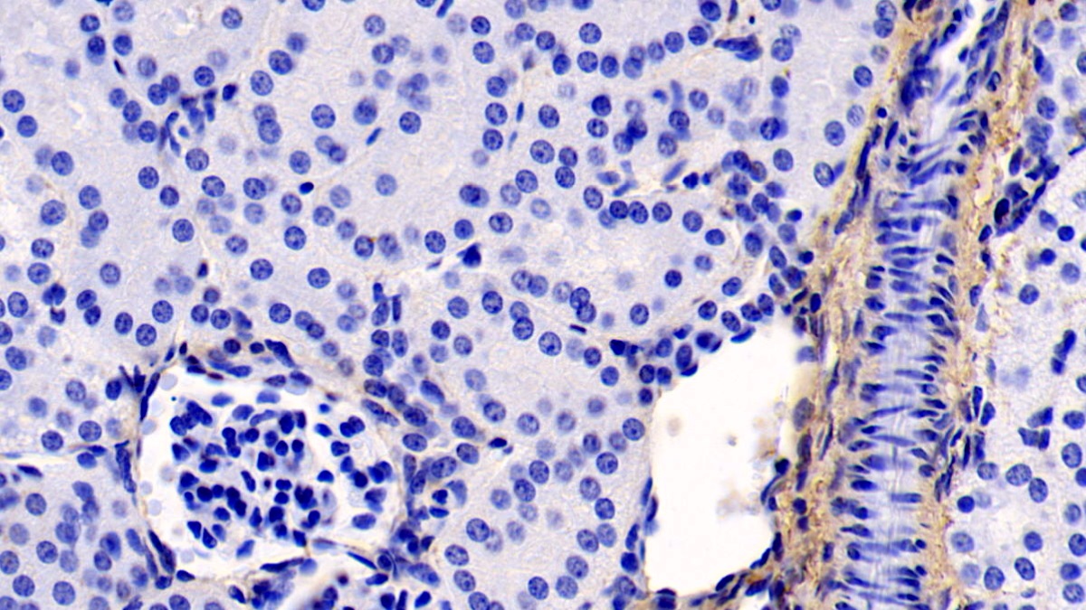 Monoclonal Antibody to Collagen Type I Alpha 1 (COL1a1)