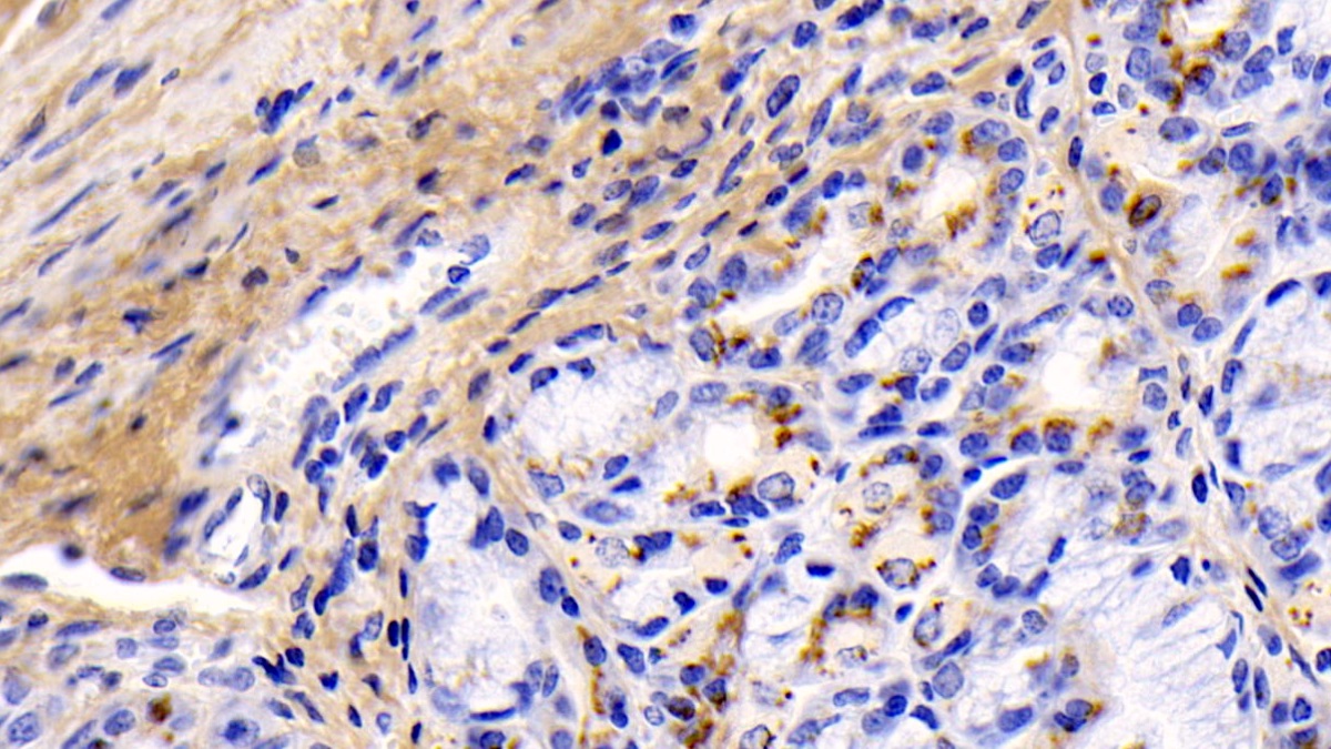 Monoclonal Antibody to Collagen Type I Alpha 1 (COL1a1)