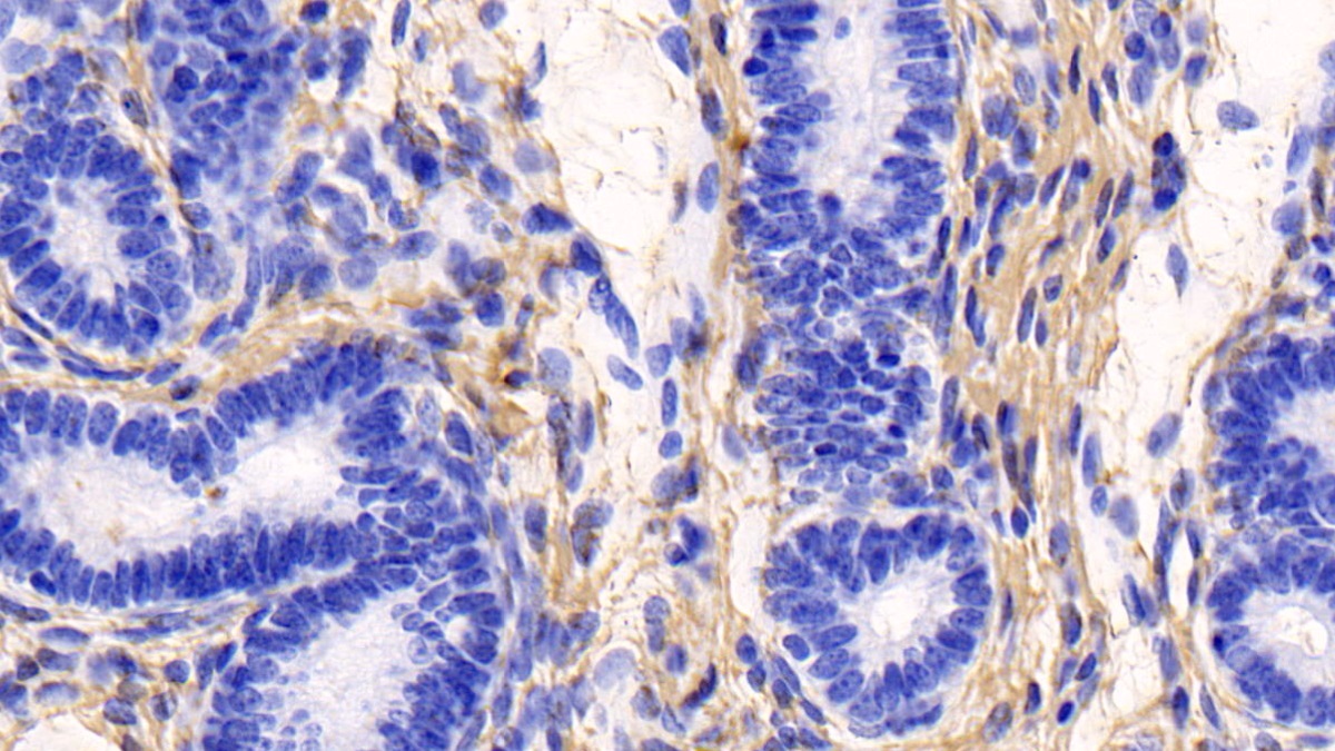 Monoclonal Antibody to Collagen Type I Alpha 1 (COL1a1)