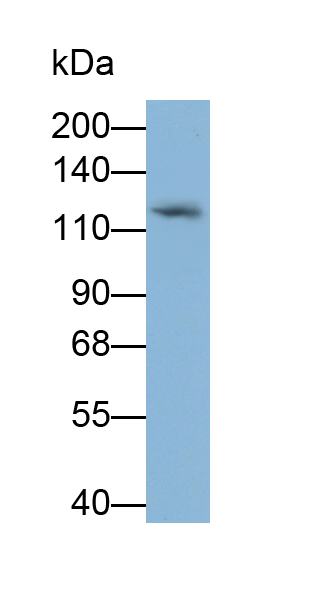 Monoclonal Antibody to Platelet/Endothelial Cell Adhesion Molecule (PECAM1)