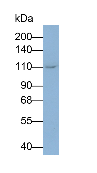 Monoclonal Antibody to Platelet/Endothelial Cell Adhesion Molecule (PECAM1)