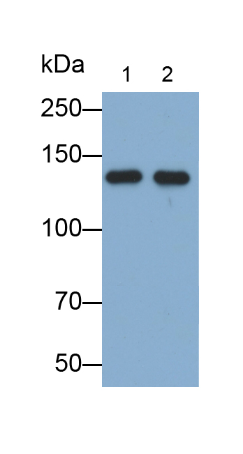 Monoclonal Antibody to Retinol Binding Protein 3, Interstitial (RBP3)