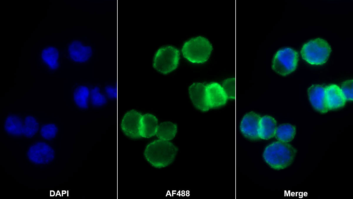 Monoclonal Antibody to Chemokine (C-X-C motif) ligand 7 ( CXCL7)