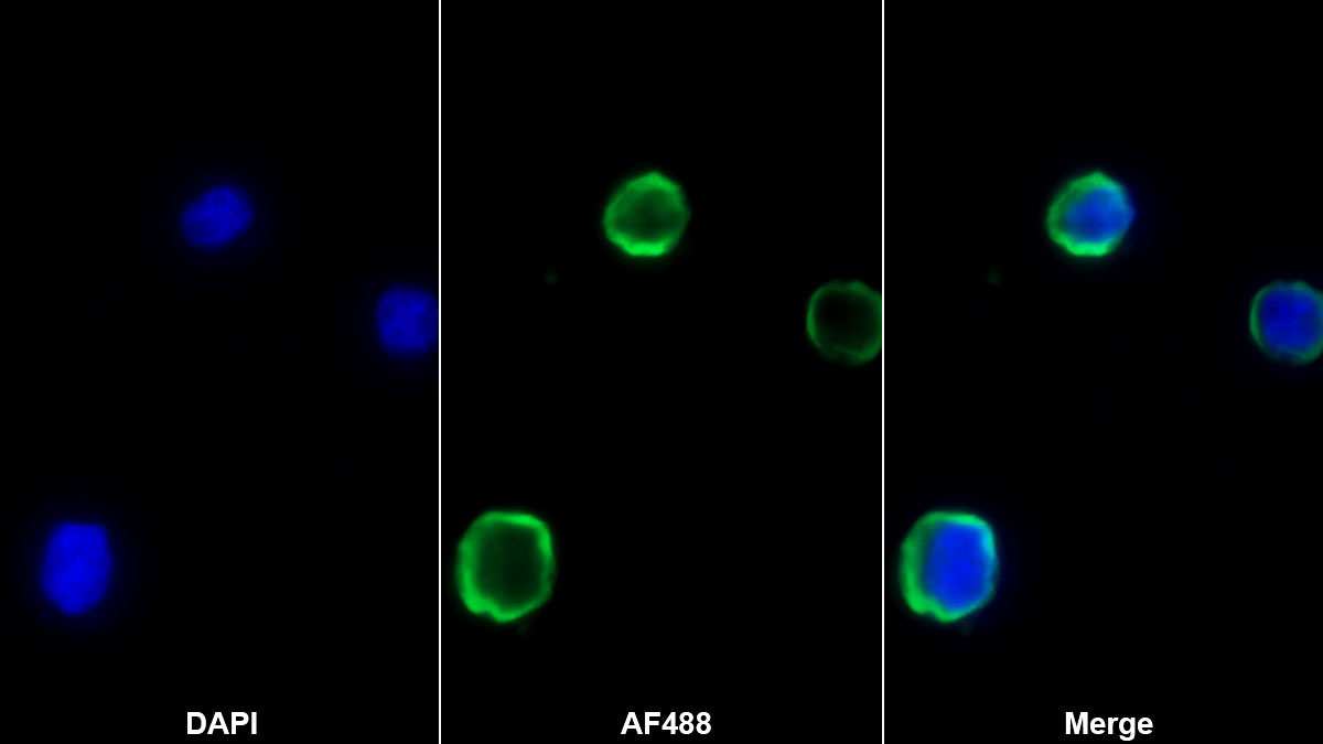 Monoclonal Antibody to Chemokine (C-X-C motif) ligand 7 ( CXCL7)