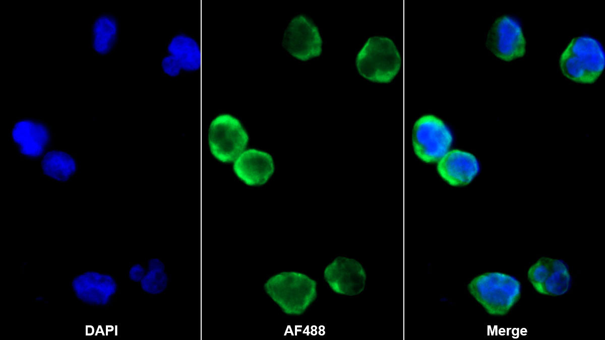 Monoclonal Antibody to Chemokine (C-X-C motif) ligand 7 ( CXCL7)