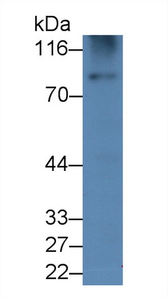 Monoclonal Antibody to Gelsolin (GSN)