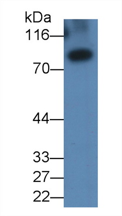 Monoclonal Antibody to Gelsolin (GSN)