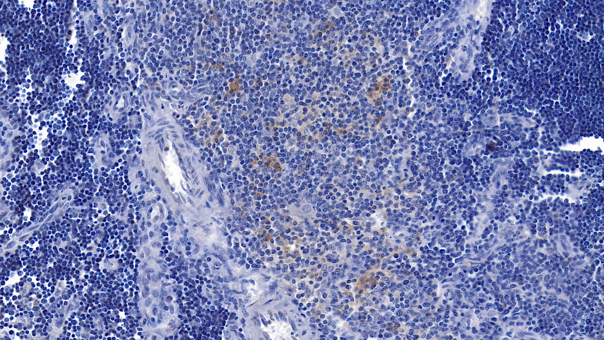 Monoclonal Antibody to Gelsolin (GSN)