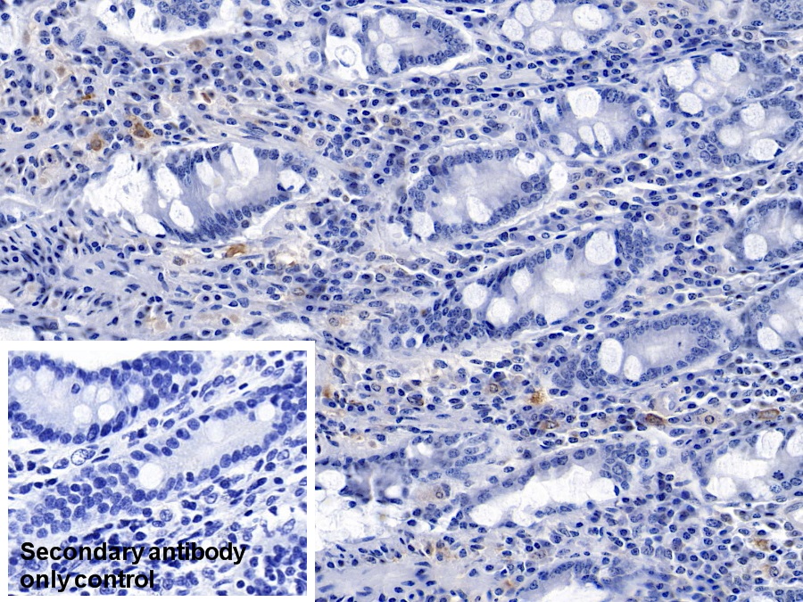 Monoclonal Antibody to Gelsolin (GSN)