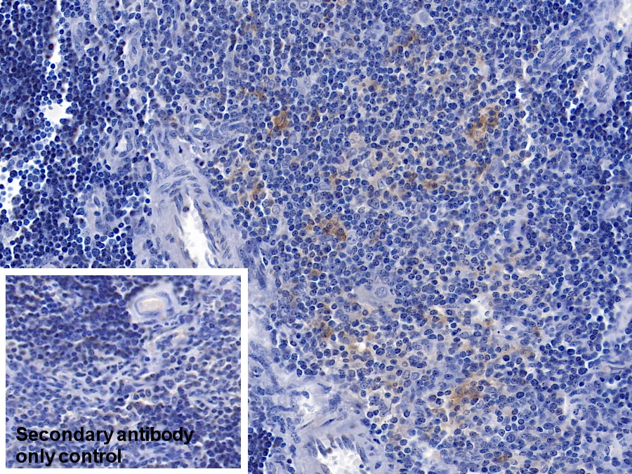 Monoclonal Antibody to Gelsolin (GSN)