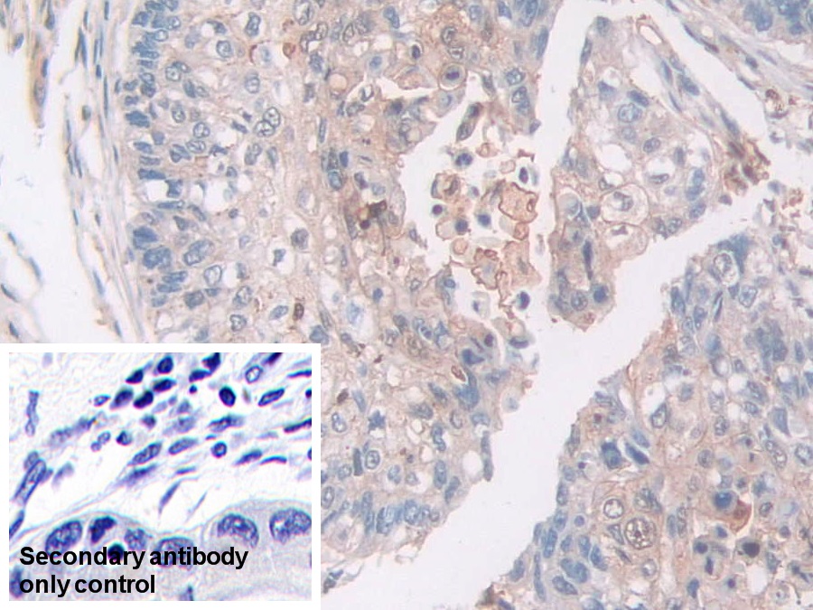 Monoclonal Antibody to Gelsolin (GSN)