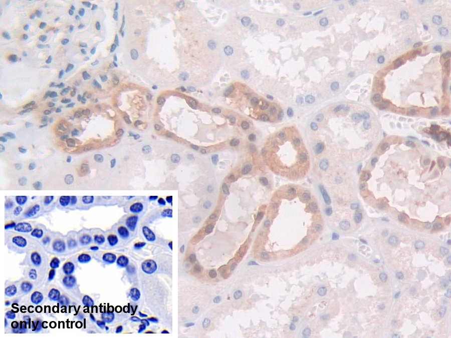 Monoclonal Antibody to Gelsolin (GSN)