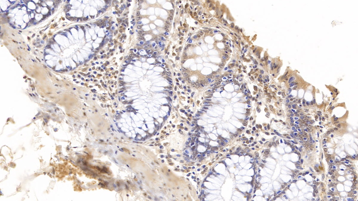 Monoclonal Antibody to Gelsolin (GSN)