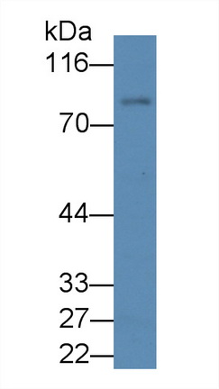 Monoclonal Antibody to Gelsolin (GSN)