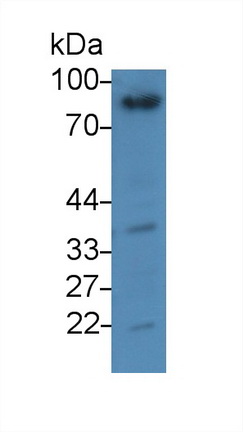 Monoclonal Antibody to Gelsolin (GSN)