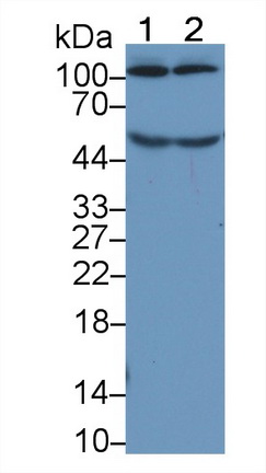 Monoclonal Antibody to Complement Component 5a (C5a)