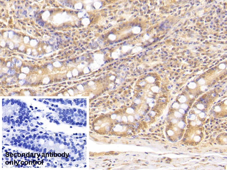 Monoclonal Antibody to Complement Component 5a (C5a)