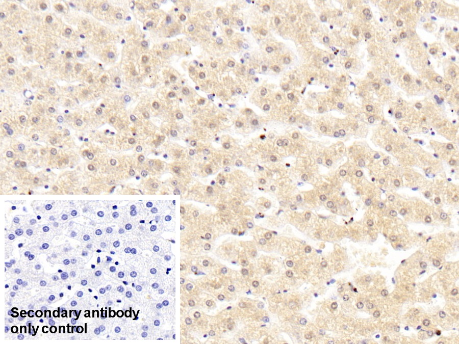 Monoclonal Antibody to Complement Component 5a (C5a)