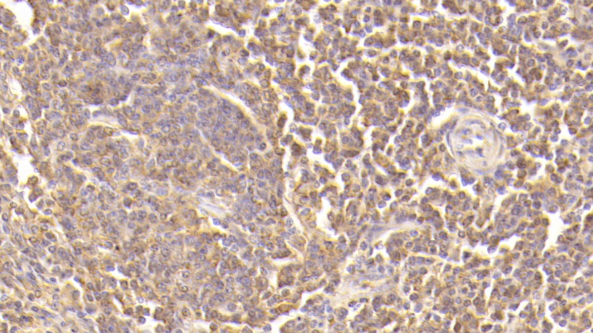 Monoclonal Antibody to Complement Component 5a (C5a)