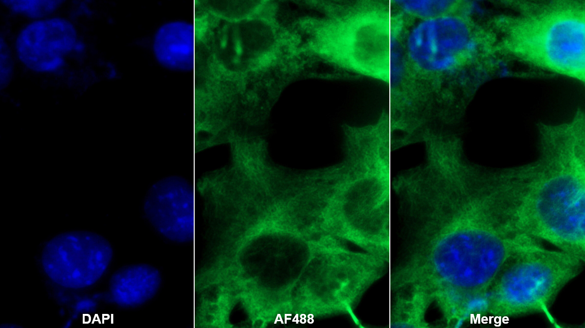 Monoclonal Antibody to Complement Component 5a (C5a)