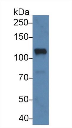 Monoclonal Antibody to Complement Component 5a (C5a)