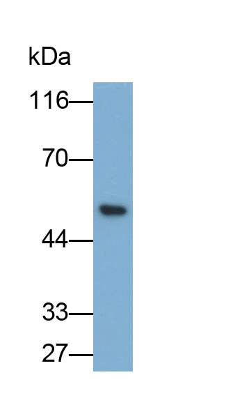 Monoclonal Antibody to Tissue Factor Pathway Inhibitor (TFPI)