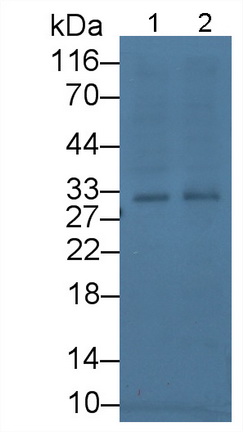 Monoclonal Antibody to Tissue Factor Pathway Inhibitor (TFPI)