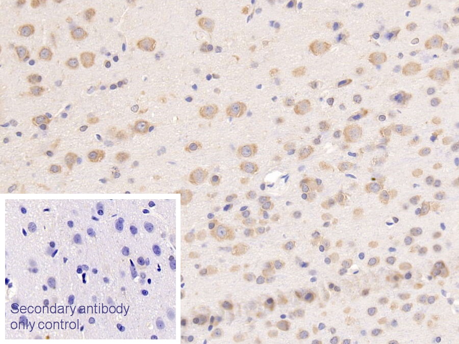 Monoclonal Antibody to Tissue Factor Pathway Inhibitor (TFPI)