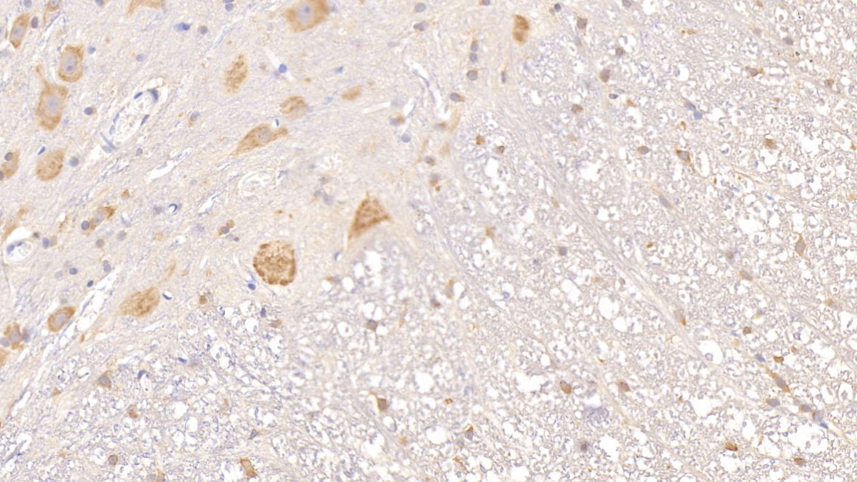 Monoclonal Antibody to Tissue Factor Pathway Inhibitor (TFPI)