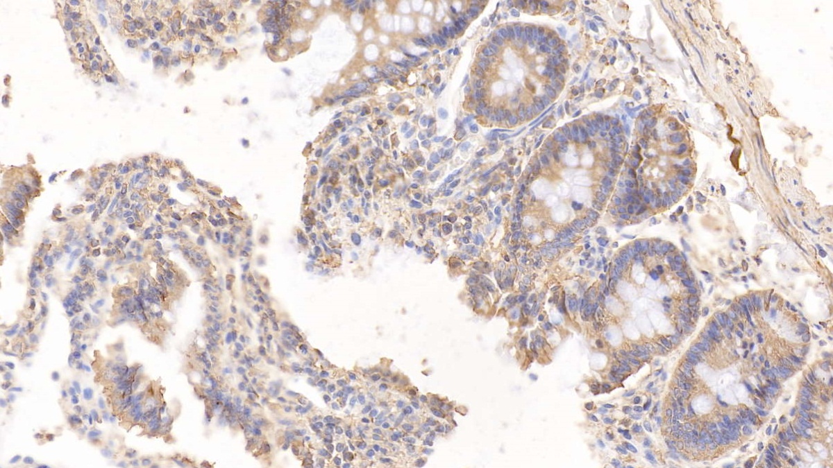 Monoclonal Antibody to Tissue Factor Pathway Inhibitor (TFPI)