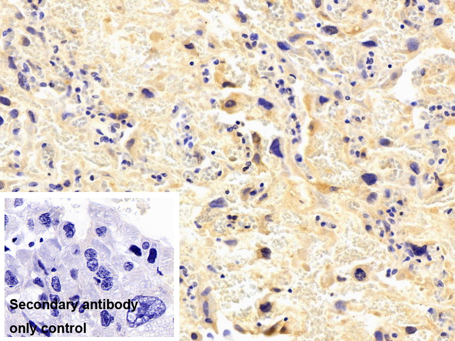 Monoclonal Antibody to Tissue Factor Pathway Inhibitor (TFPI)