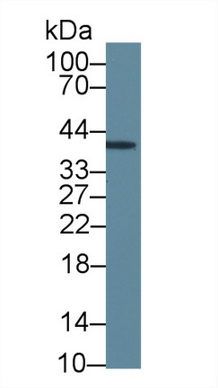 Monoclonal Antibody to Inhibin Alpha (INHa)