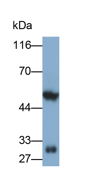 Monoclonal Antibody to Inhibin Alpha (INHa)