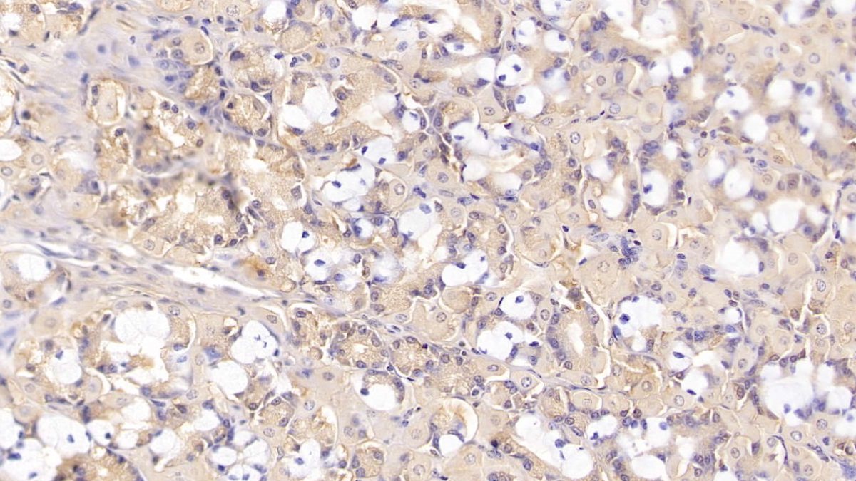 Monoclonal Antibody to Sex Hormone Binding Globulin (SHBG)