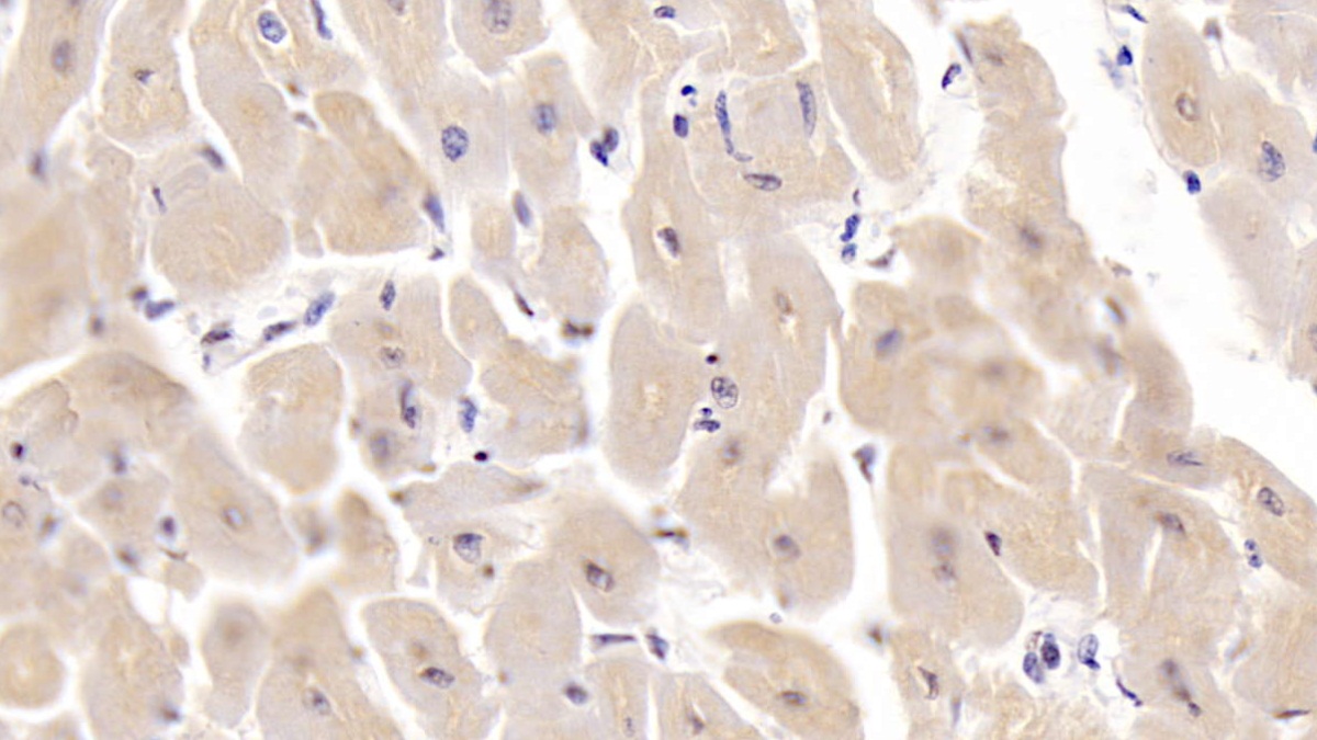 Monoclonal Antibody to Sex Hormone Binding Globulin (SHBG)