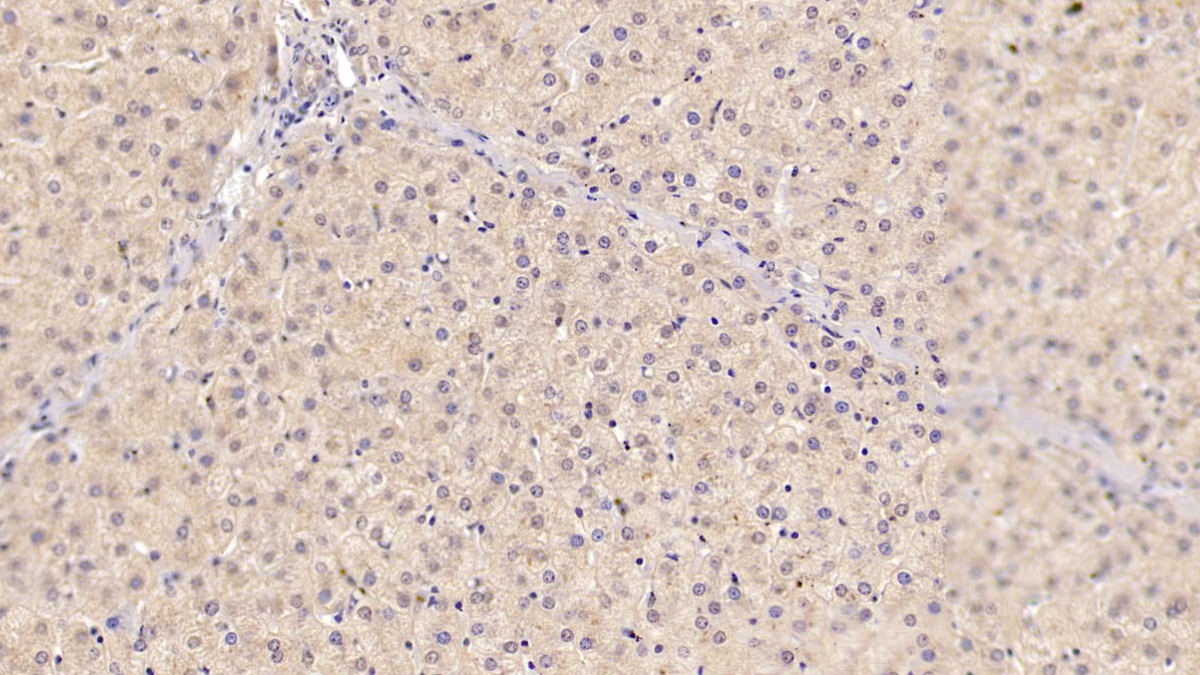 Monoclonal Antibody to Sex Hormone Binding Globulin (SHBG)