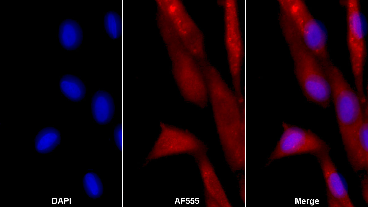 Monoclonal Antibody to Sex Hormone Binding Globulin (SHBG)