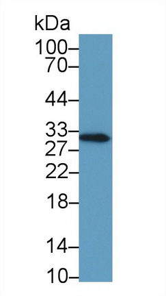 Monoclonal Antibody to High Mobility Group Protein 1 (HMGB1)