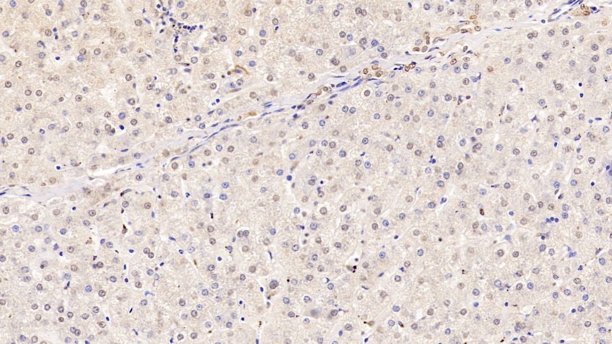 Monoclonal Antibody to High Mobility Group Protein 1 (HMGB1)