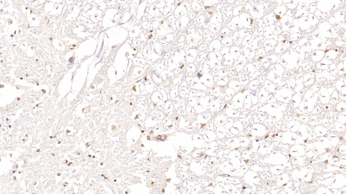 Monoclonal Antibody to High Mobility Group Protein 1 (HMGB1)