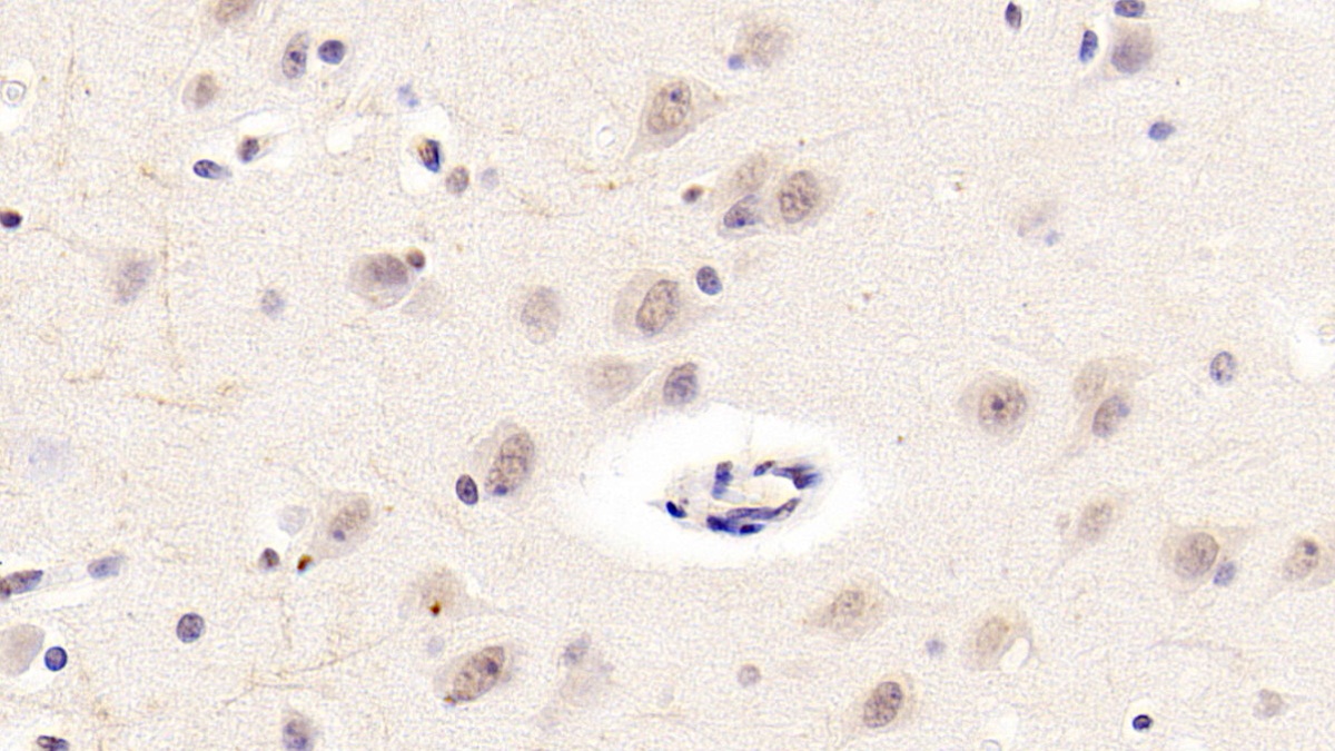 Monoclonal Antibody to Neurogranin (NRGN)