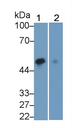 Monoclonal Antibody to GATA Binding Protein 3 (GATA3)