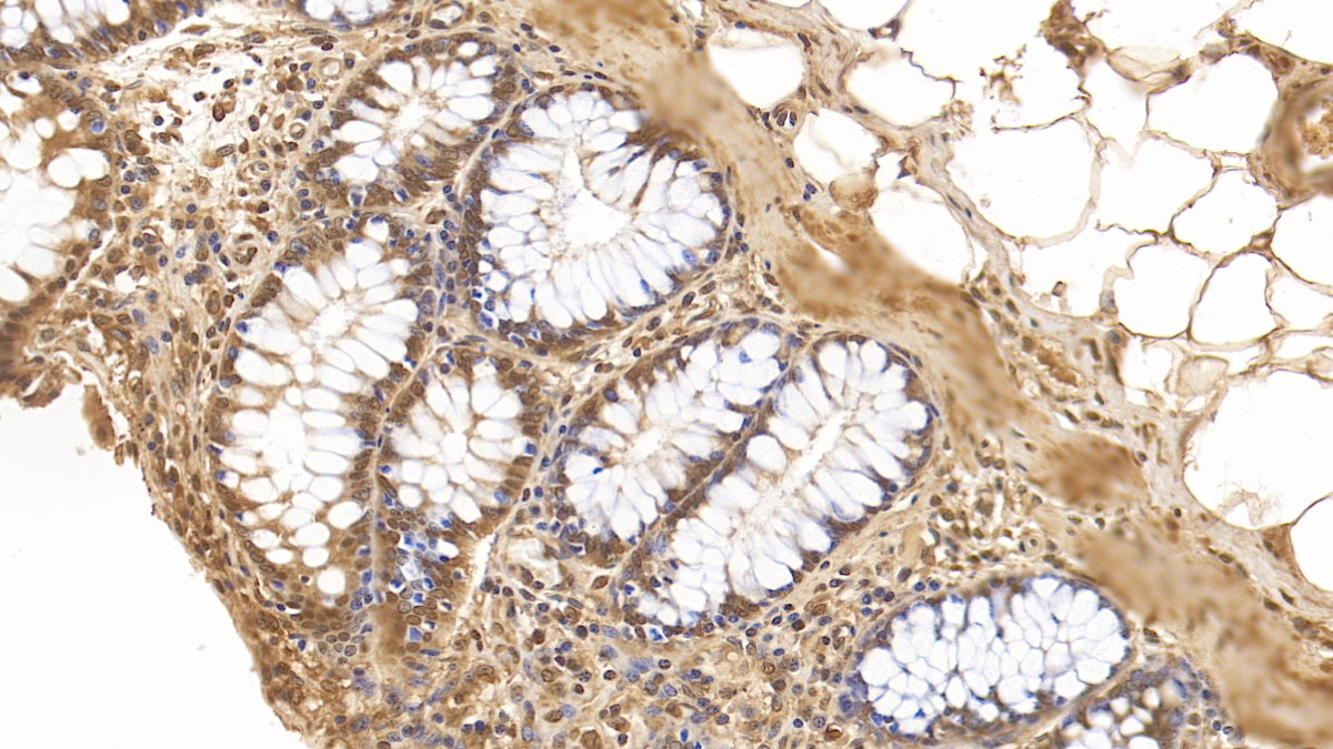 Monoclonal Antibody to GATA Binding Protein 3 (GATA3)