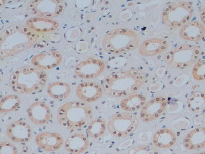 Monoclonal Antibody to GATA Binding Protein 3 (GATA3)