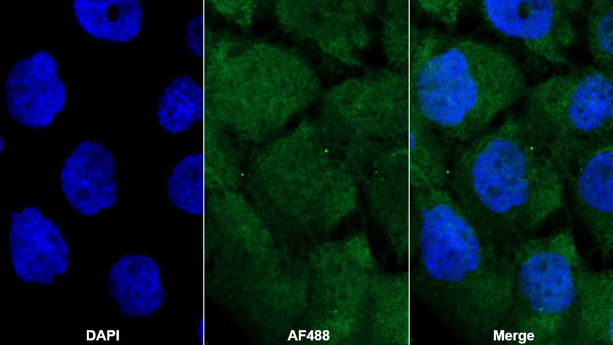 Monoclonal Antibody to GATA Binding Protein 3 (GATA3)